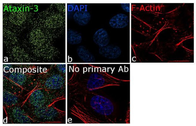 Ataxin 3 Antibody in Immunocytochemistry (ICC/IF)