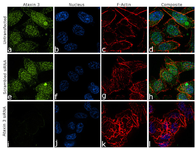 Ataxin 3 Antibody in Immunocytochemistry (ICC/IF)