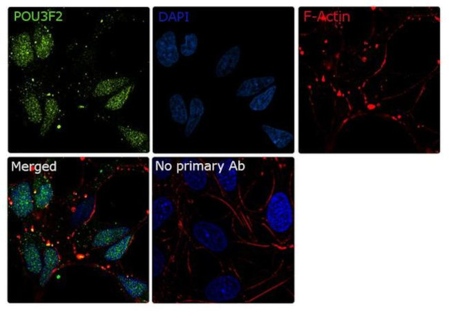 POU3F2 Antibody in Immunocytochemistry (ICC/IF)