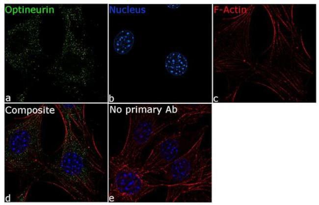 Optineurin Antibody in Immunocytochemistry (ICC/IF)