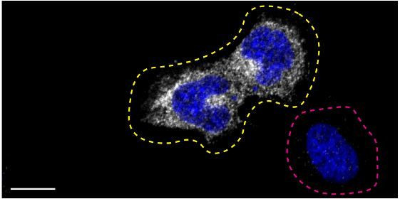 Optineurin Antibody in Immunocytochemistry (ICC/IF)