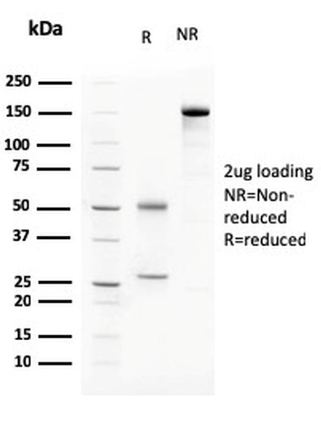 C1QA/Complement C1q A-Chain Antibody in SDS-PAGE (SDS-PAGE)