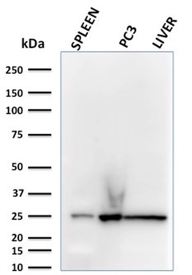 C1QA/Complement C1q A-Chain Antibody in Western Blot (WB)