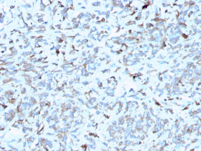 C1QA/Complement C1q A-Chain Antibody in Immunohistochemistry (Paraffin) (IHC (P))