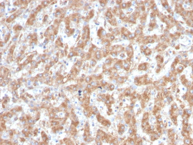 C1QA/Complement C1q A-Chain Antibody in Immunohistochemistry (Paraffin) (IHC (P))