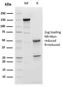 C1QA/Complement C1q A-Chain Antibody in SDS-PAGE (SDS-PAGE)