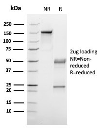 C1QA/Complement C1q A-Chain Antibody in SDS-PAGE (SDS-PAGE)