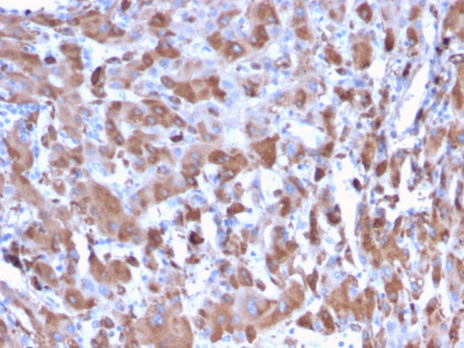 C1QA/Complement C1q A-Chain Antibody in Immunohistochemistry (Paraffin) (IHC (P))