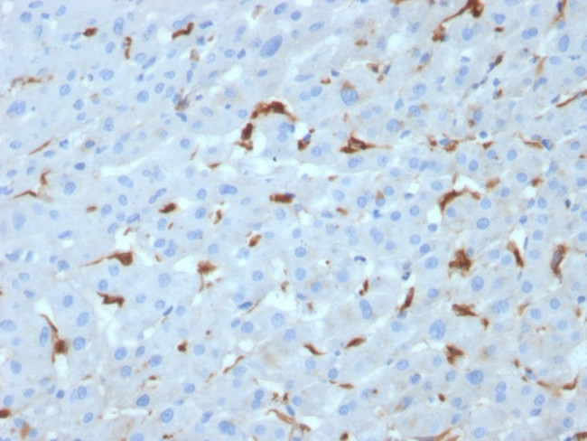 C1QA/Complement C1q A-Chain Antibody in Immunohistochemistry (Paraffin) (IHC (P))