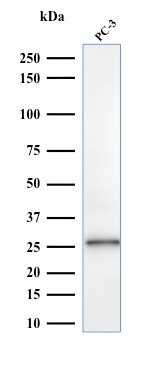 C1QA/Complement C1q A-Chain Antibody in Western Blot (WB)