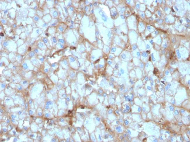 C1QA/Complement C1q A-Chain Antibody in Immunohistochemistry (Paraffin) (IHC (P))