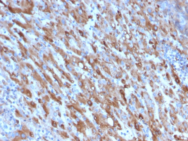 C1QA/Complement C1q A-Chain Antibody in Immunohistochemistry (Paraffin) (IHC (P))