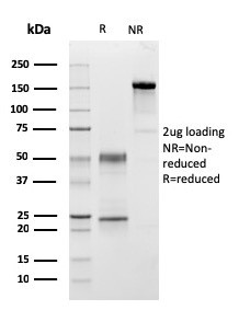 C1QA/Complement C1q A-Chain Antibody in SDS-PAGE (SDS-PAGE)