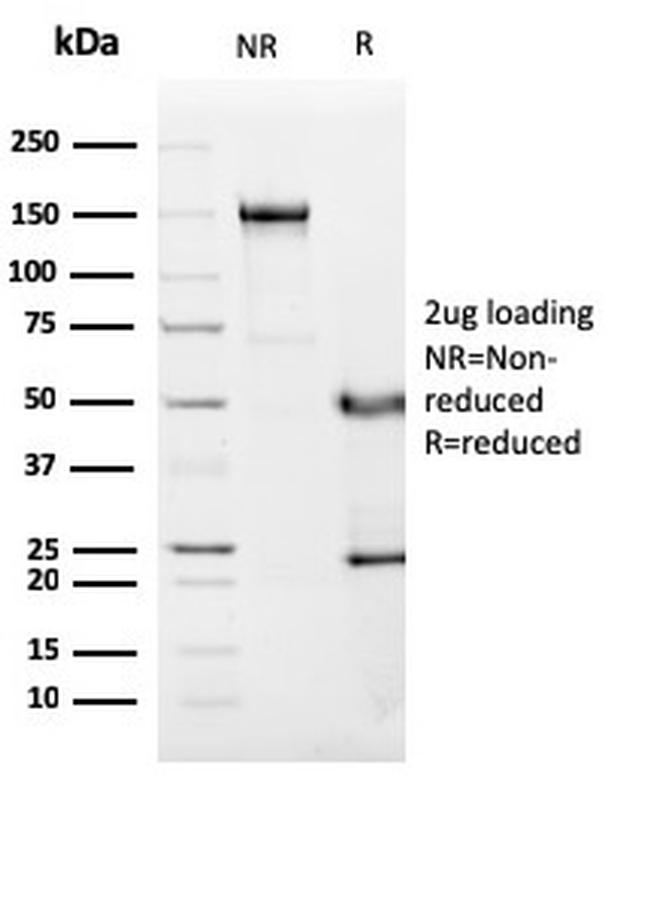 C1QA/Complement C1q A-Chain Antibody in SDS-PAGE (SDS-PAGE)