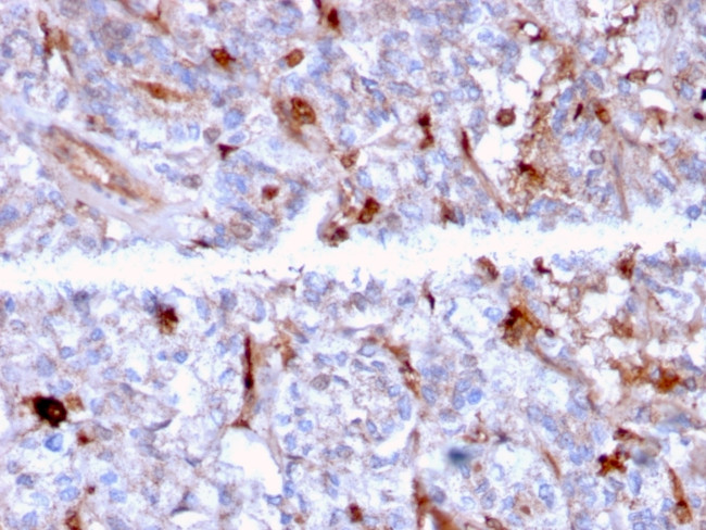 C1QA/Complement C1q A-Chain Antibody in Immunohistochemistry (Paraffin) (IHC (P))