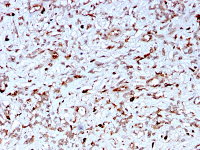 C1QA/Complement C1q A-Chain Antibody in Immunohistochemistry (Paraffin) (IHC (P))