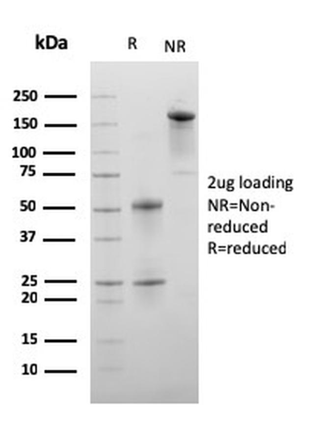 C1QA/Complement C1q A-Chain Antibody in SDS-PAGE (SDS-PAGE)