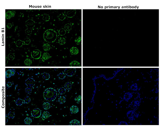 Lamin B1 Antibody in Immunohistochemistry (Paraffin) (IHC (P))