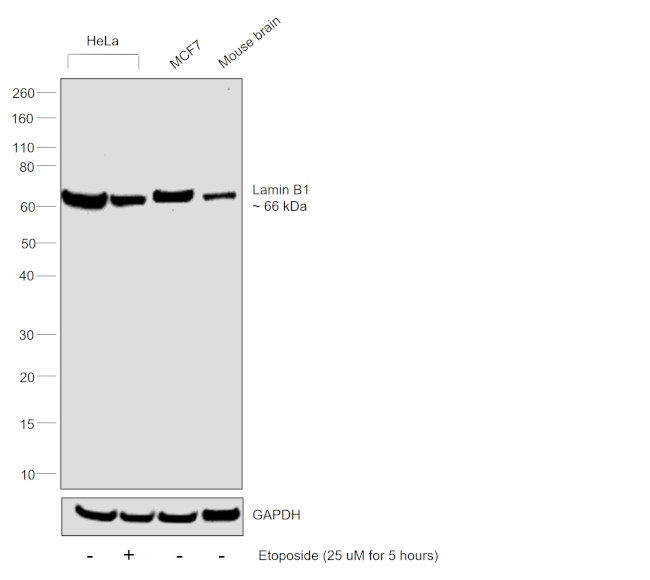 Lamin B1 Antibody in Western Blot (WB)