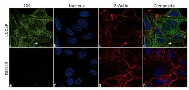 JIK Antibody in Immunocytochemistry (ICC/IF)