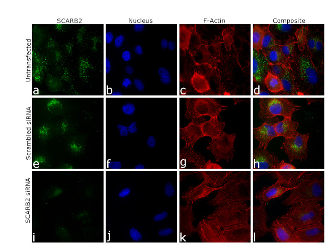 LIMP2 Antibody in Immunocytochemistry (ICC/IF)