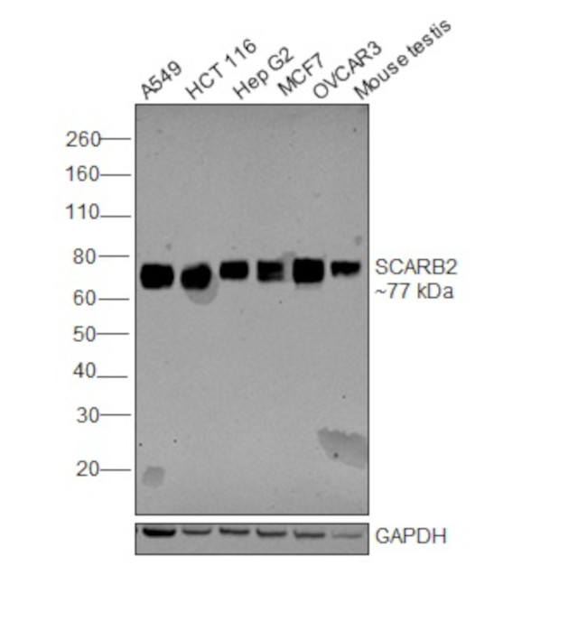 LIMP2 Antibody in Western Blot (WB)