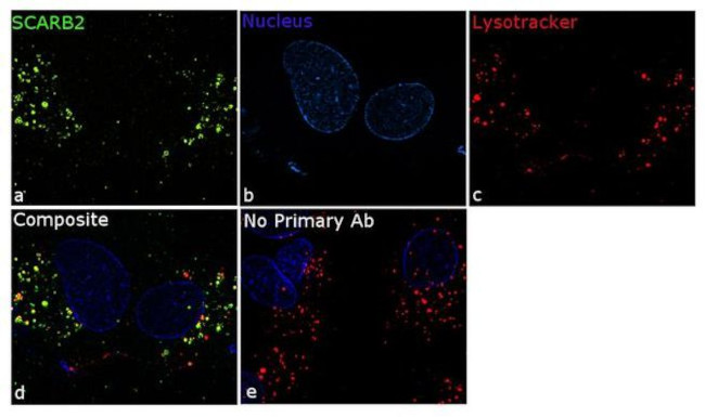 LIMP2 Antibody in Immunocytochemistry (ICC/IF)