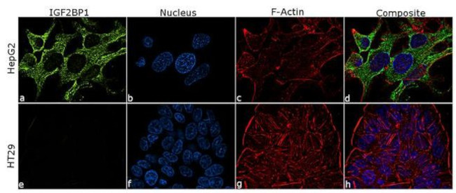 IGF2BP1 Antibody in Immunocytochemistry (ICC/IF)