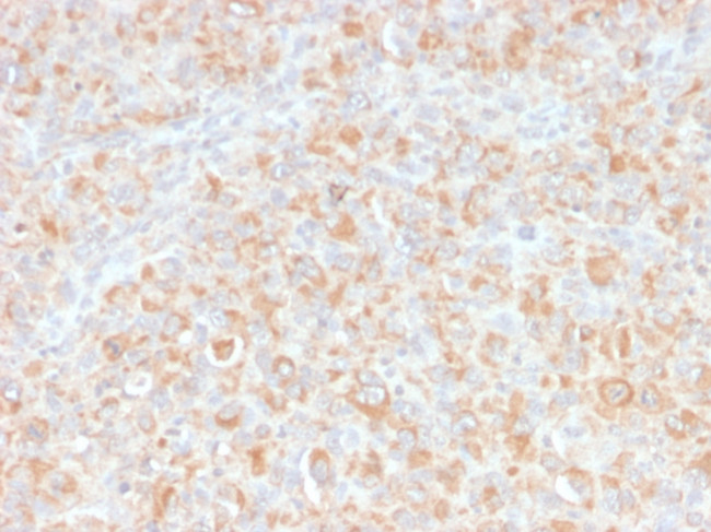 TNF-alpha (Tumor Necrosis Factor alpha) Antibody in Immunohistochemistry (Paraffin) (IHC (P))