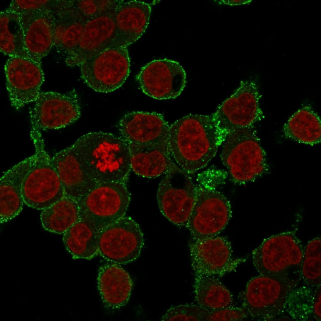 TNF-alpha (Tumor Necrosis Factor alpha) Antibody in Immunocytochemistry (ICC/IF)