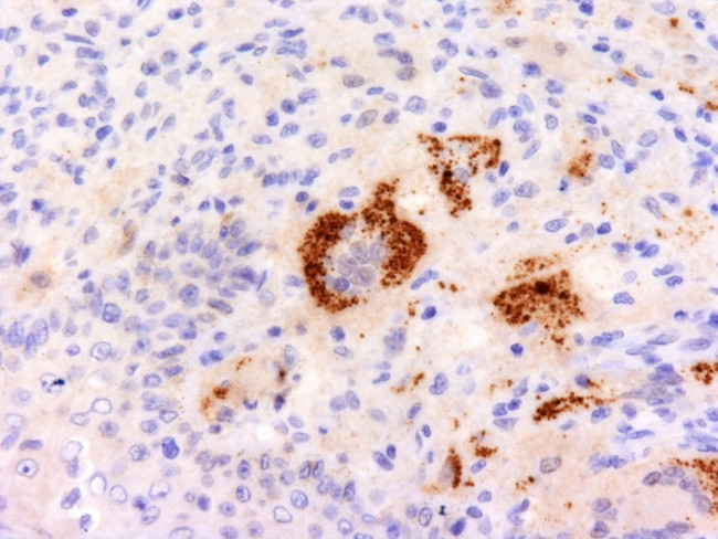 TNF-alpha (Tumor Necrosis Factor alpha) Antibody in Immunohistochemistry (Paraffin) (IHC (P))