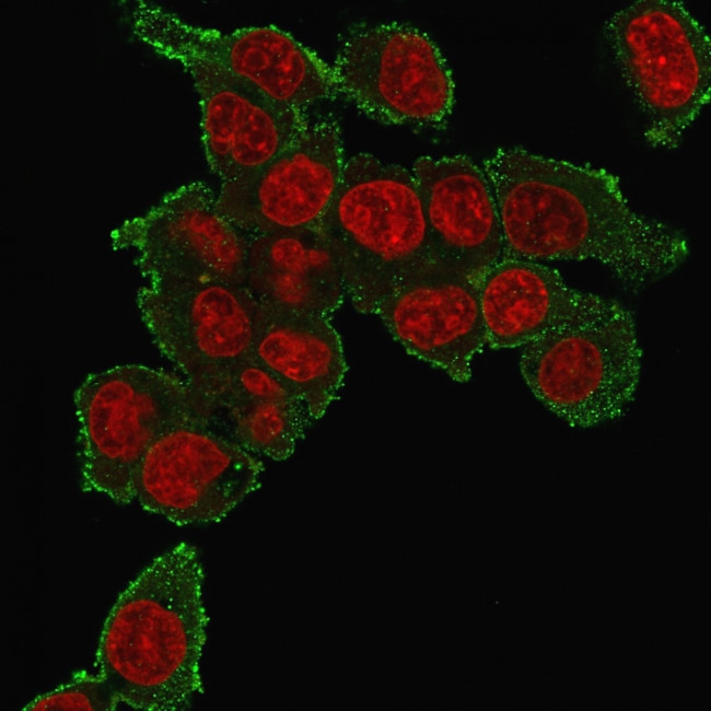 TNF-alpha (Tumor Necrosis Factor alpha) Antibody in Immunocytochemistry (ICC/IF)