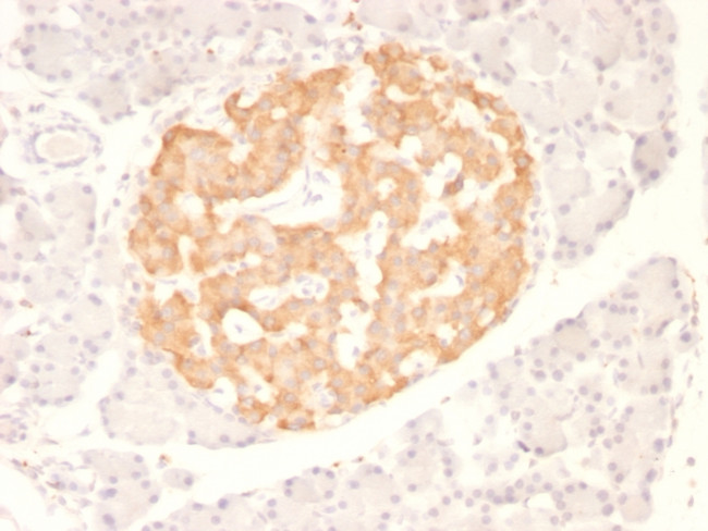 TNF-alpha (Tumor Necrosis Factor alpha) Antibody in Immunohistochemistry (Paraffin) (IHC (P))