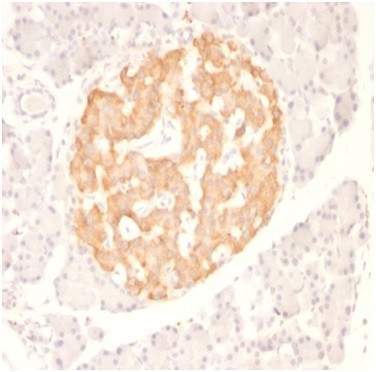 TNF-alpha (TumorNecrosis Factor alpha) Antibody in Immunohistochemistry (Paraffin) (IHC (P))