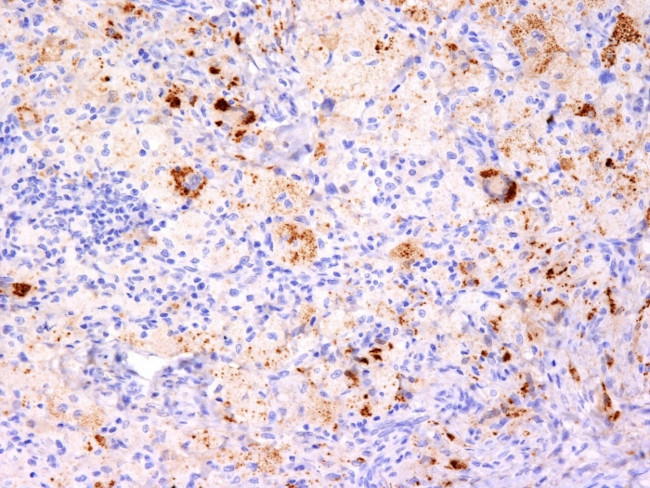 TNF-alpha (Tumor Necrosis Factor alpha) Antibody in Immunohistochemistry (Paraffin) (IHC (P))