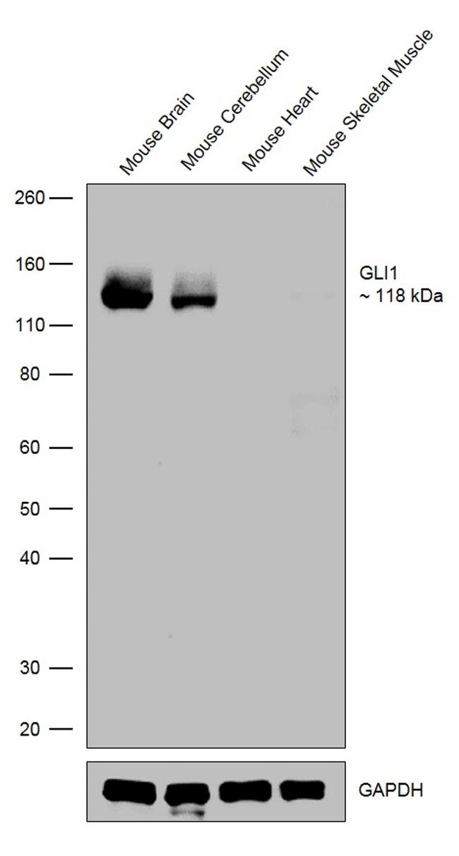 GLI1 Antibody in Western Blot (WB)