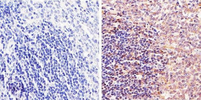 STAT5 beta Antibody in Immunohistochemistry (Paraffin) (IHC (P))