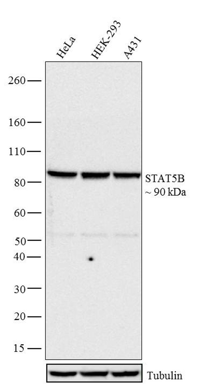 STAT5 beta Antibody in Western Blot (WB)