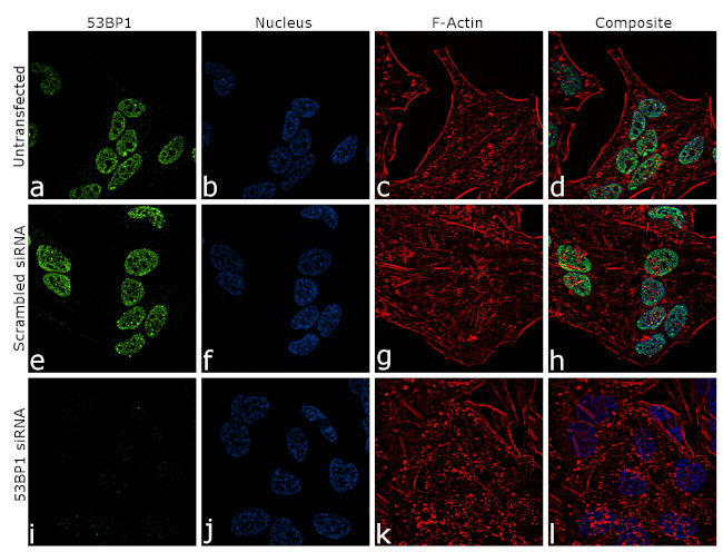 53BP1 Antibody