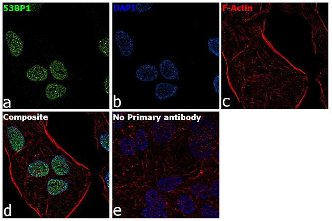 53BP1 Antibody in Immunocytochemistry (ICC/IF)