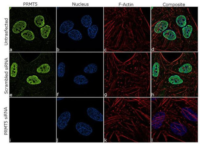 PRMT5 Antibody in Immunocytochemistry (ICC/IF)