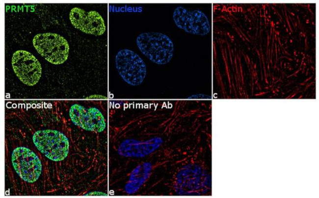 PRMT5 Antibody in Immunocytochemistry (ICC/IF)