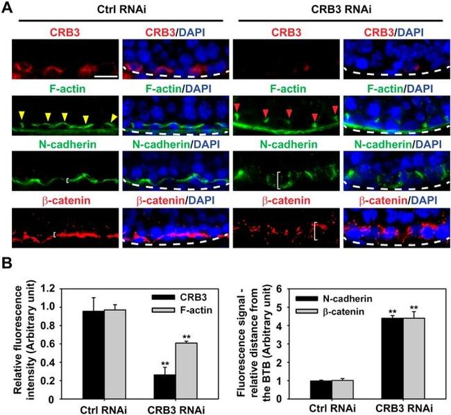 beta Catenin Antibody in Immunohistochemistry (IHC)