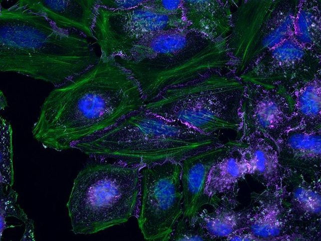 beta Catenin Antibody in Immunocytochemistry (ICC/IF)