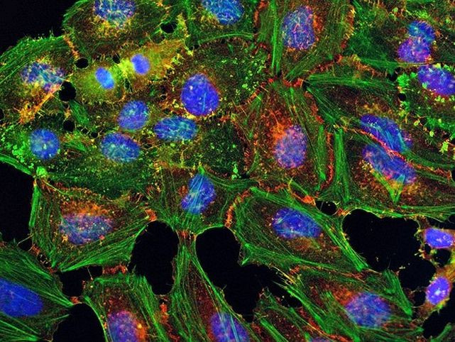 beta Catenin Antibody in Immunocytochemistry (ICC/IF)