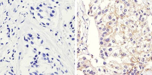 beta Catenin Antibody in Immunohistochemistry (Paraffin) (IHC (P))