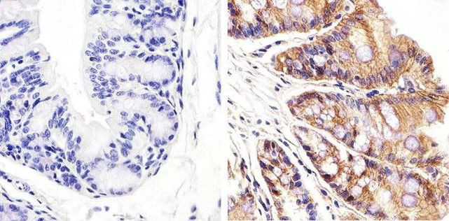 beta Catenin Antibody in Immunohistochemistry (Paraffin) (IHC (P))