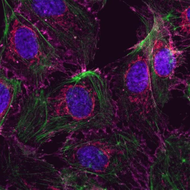 beta Catenin Antibody in Immunocytochemistry (ICC/IF)