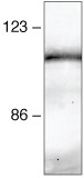 beta Catenin Antibody in Immunoprecipitation (IP)