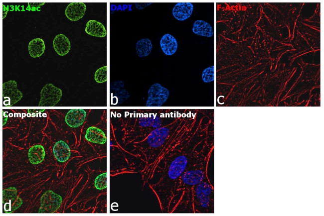 H3K14ac Antibody in Immunocytochemistry (ICC/IF)